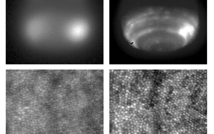 Images of Neptune (top) and cone photoreceptors in a living human retina (bottom) with and without the use of adaptive optics (left and right, respectively). The bright spots in the retinal image are individual cone cells, and the vertical line is the shadow of a blood vessel. The diameter of each cone is about five microns. (Neptune: Claire Max; retinas: Austin Roorda)