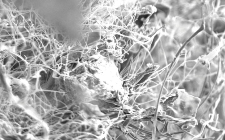 Scanning electron microscope of mycelium. Credit: Sonia Travaglini